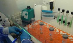 Urfa’da kurulan Tüberküloz Laboratuvarı bölgeye hizmet verecek
