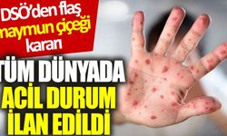 DSÖ’den ‘maymun çiçeği’ kararı: Tüm dünyada acil durum ilan edildi